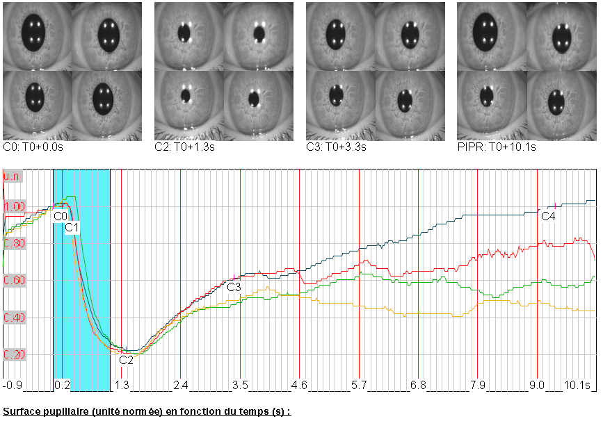 Superposition of several collections of reflex chromatic pupillometry